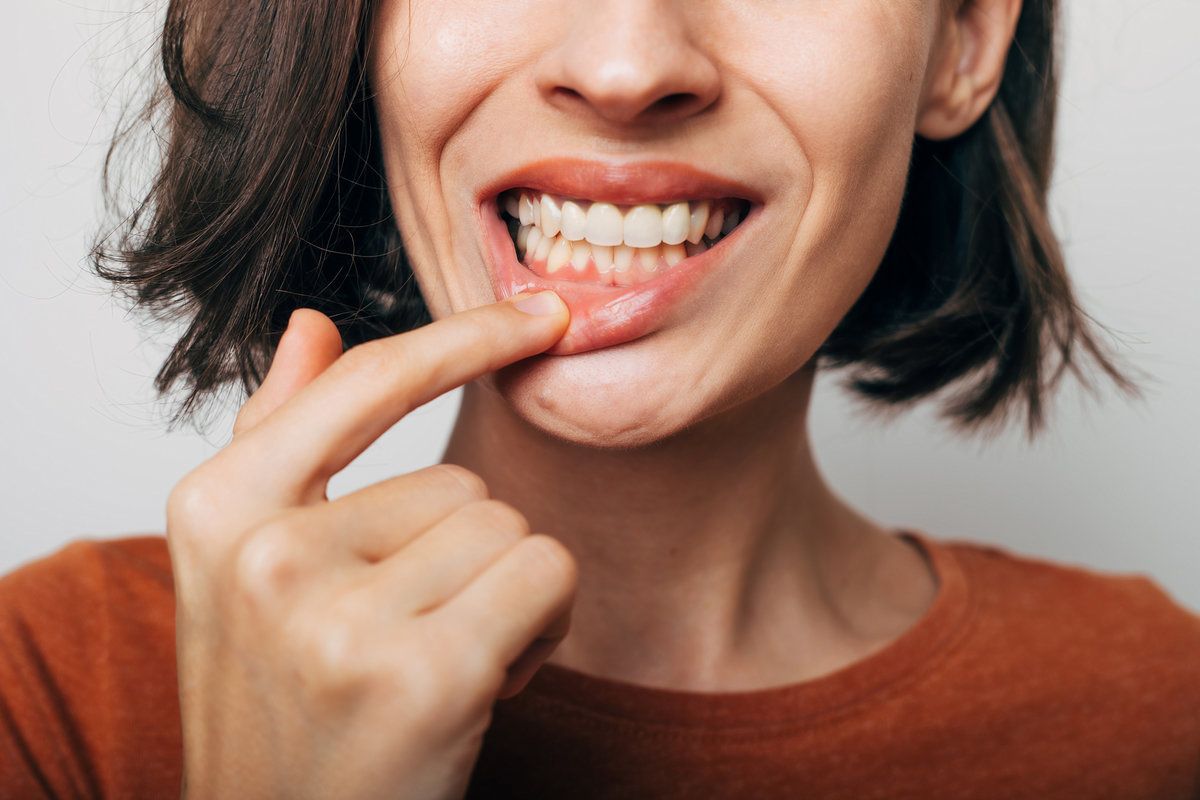Woman pointing at her gums
